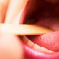 Bademcik şişmesine ne iyi gelir - Boğaz ağrısının nedenleri, Bademcik iltihabı nasıl geçer