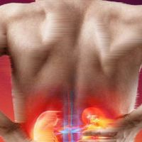 Böbrek iltihabı nedir, belirtileri nelerdir, kimlerde görülür, genetik midir?