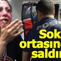 Bursa'da sokak ortasında saldırdı