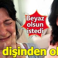 Diş beyazlatmak isterken 32 dişinden oldu | Delirten hastalık trigeminal nevralji nedir?