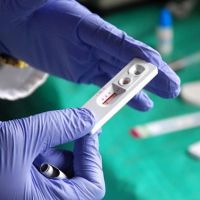 Dünyada azalan AIDS, Türkiye'de artıyor
