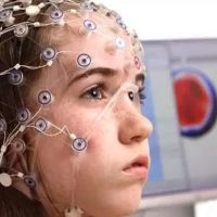 EEG nedir ( Elektroensefalografi ) neden çekilir, ücretli mi?