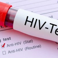 Hiv nedir? Hiv virüsü ne demek? Hiv virüsü nedir? Aids nasıl bulaşır?