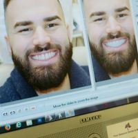 7 milyon hastanın umudu Invisalign!