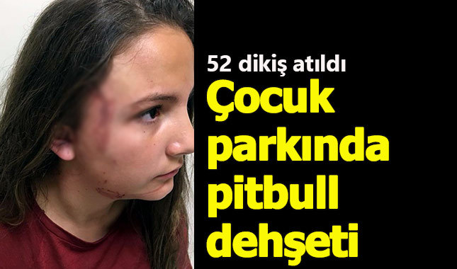 12 yaşındaki kıza pitbull saldırdı - Tekirdağ haberleri