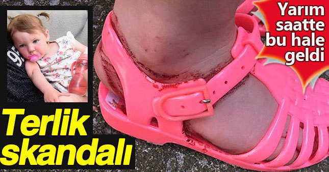 2 yaşındaki bir kız çocuğunun ayakları giydiği jel sandaletlerden dolayı yaralandı