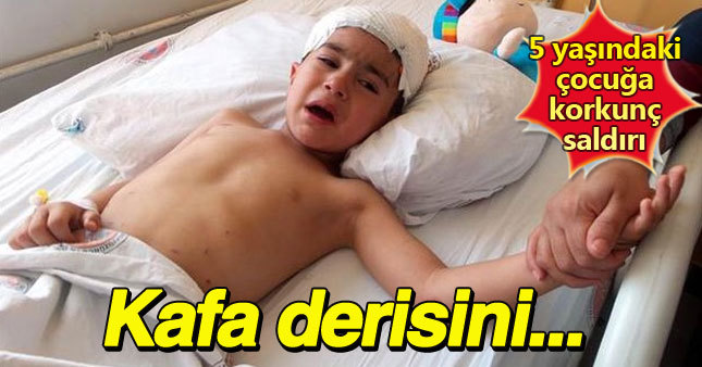 5 yaşındaki çocuğa korkunç saldırı