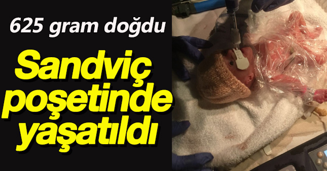 6 aylık sandviç poşetinde yaşatıldı