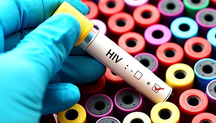 AIDS tedavisinde devrim gibi buluş!