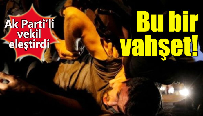 Ak Parti'li vekil, polisin tavrını eleştirdi!