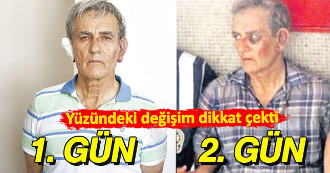 Akın Öztürk'ün yüzü 2 günde değişti