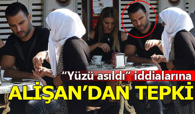 Alişan'dan 'yüzü asıldı' iddialarına sert tepki