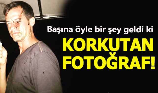 Alp Kırşan'ın görüntüsü büyük endişe yarattı