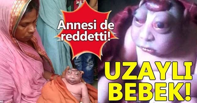 Annesinin emzirmeyi reddettiği çocuk gündeme oturdu