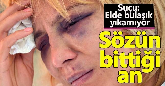 Bulaşığı elde yıkadığı için hastanelik oldu