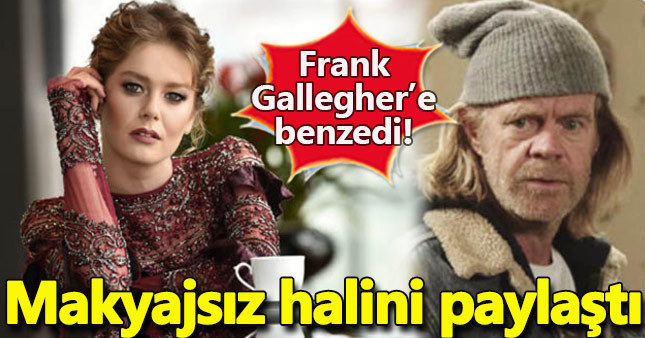 Burcu Biricik'in Frank Gallegher'e benzeyen makyajsız hali