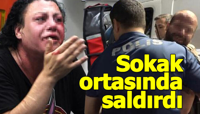 Bursa'da sokak ortasında saldırdı