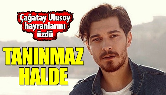 Çağatay Ulusoy'un tanınmaz hale gelmesi