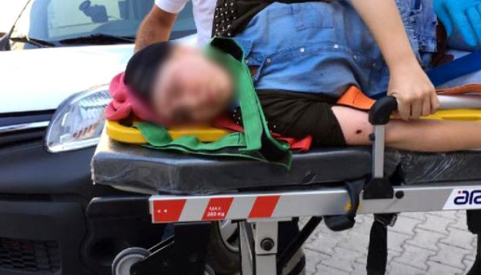 Cani baba kızını sakat bıraktı