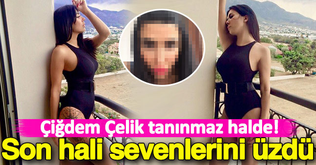 Çiğdem Çelik'in son hali sevenlerini üzdü