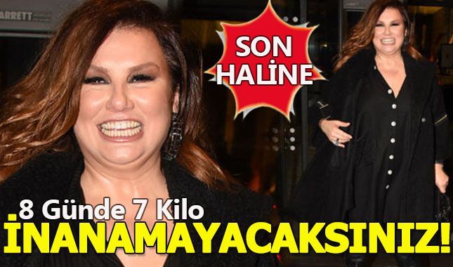 Deniz Seki'nin mide küçültme ameliyatı işe yaramış!