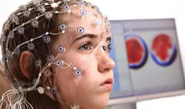 EEG nedir ( Elektroensefalografi ) neden çekilir, ücretli mi?