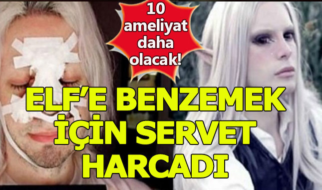 Elf olabilmek için servet harcıyor!