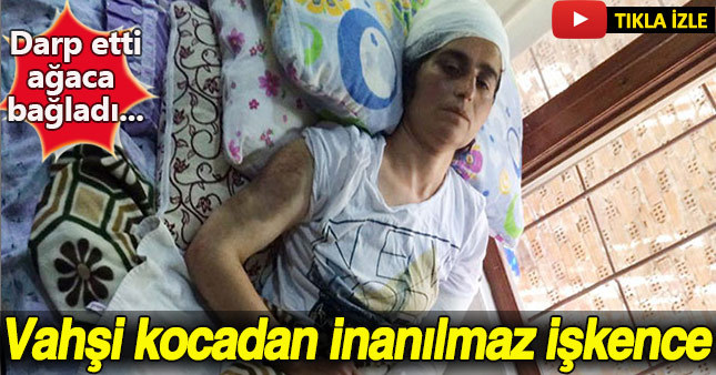 Erzincan'da koca vahşeti yaşandı