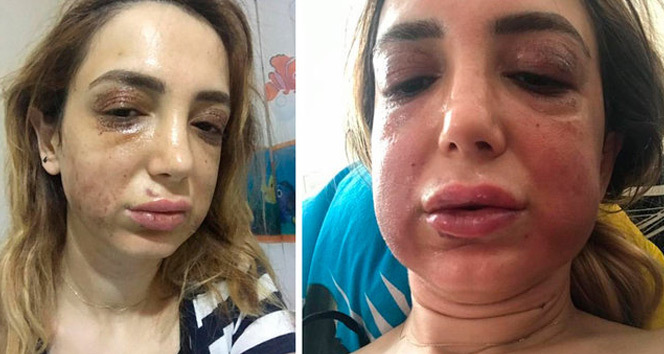 Estetikte ‘yetki' sorunu faciaya davetiye çıkarıyor