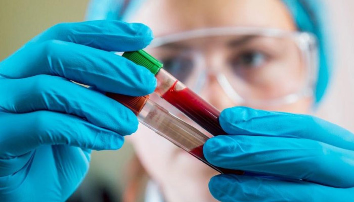 Ferritin nedir, değerleri ne anlama gelir, eksiklik ve fazlalığı ne anlama gelir?