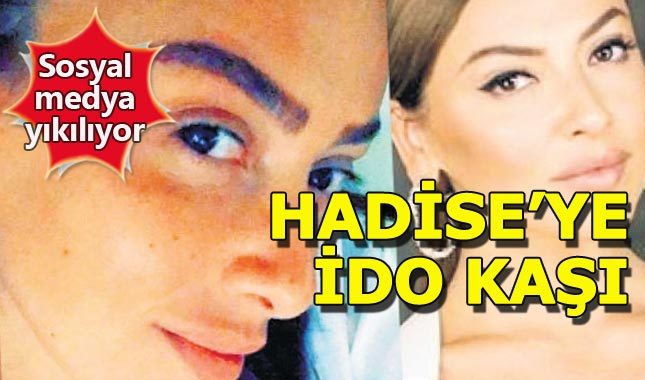 Hadise İdo kaşı mı yaptırdı?