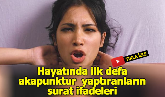 Hayatlarında ilk defa Akupunkturla tanışan insanların surat ifadeleri