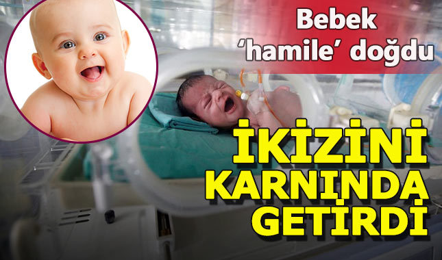 Hindistan'da bir bebek karnında ikiziyle doğdu