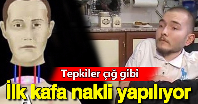 İlk kafa nakli ameliyatı nasıl yapılacak?