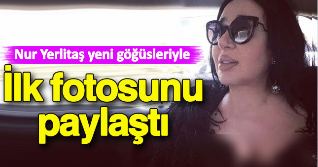 İşte Nur Yerlitaş'ın yeni göğüsleri
