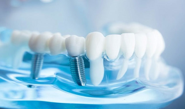 Kablosuz implant üretildi