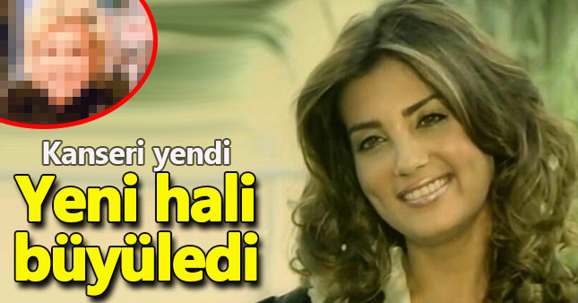 Kanseri yenen Bahar Öztan'ın yeni hali