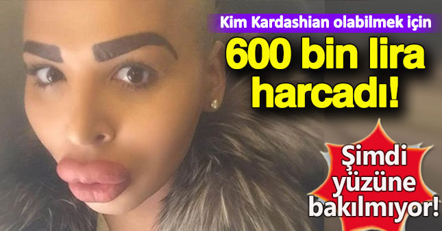 Kim Kardashian'a benzemek için servet harcadı