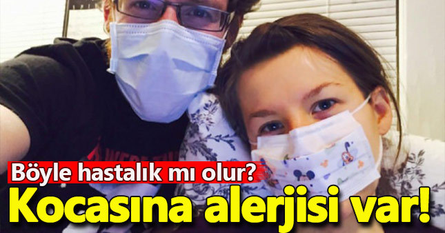 Kocasına alerjisi olan kadının büyük dramı!
