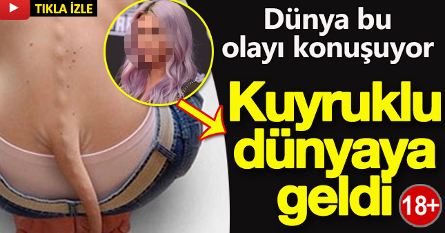 Kuyruklu olarak dünyaya geldi