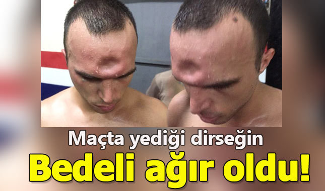 Maçta yediği dirsek ölümüne neden oluyordu!
