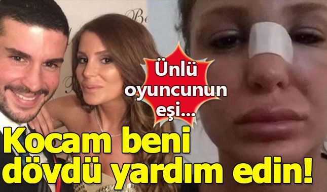 Merve Şarapçıoğlu'nun sosyal medya'da yardım çığlığı! (Berk Oktay kimdir? ne zaman evlendi)