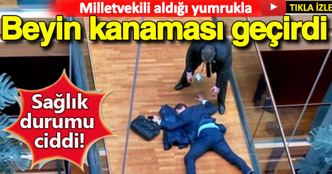 Milletvekili aldığı yumrukla beyin kanaması geçirdi