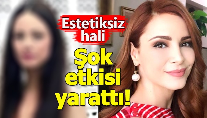 Mine Tugay'ın estetiksiz hali