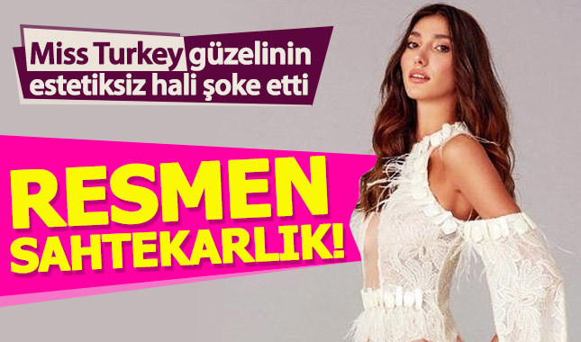 Miss Turkey 2018 birincisi Şevval Şahin'in estetiksiz hali şoke etti