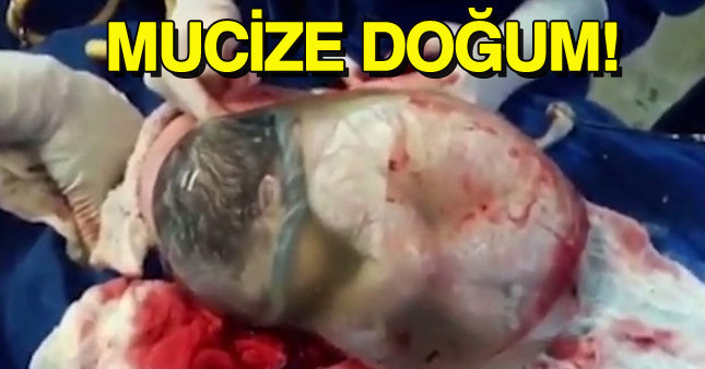 Mucize doğum doktorları şaşkına çevirdi