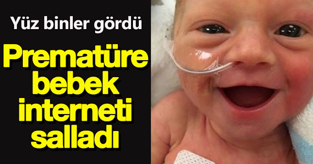 Prematüre Bebek sosyal medyayı salladı