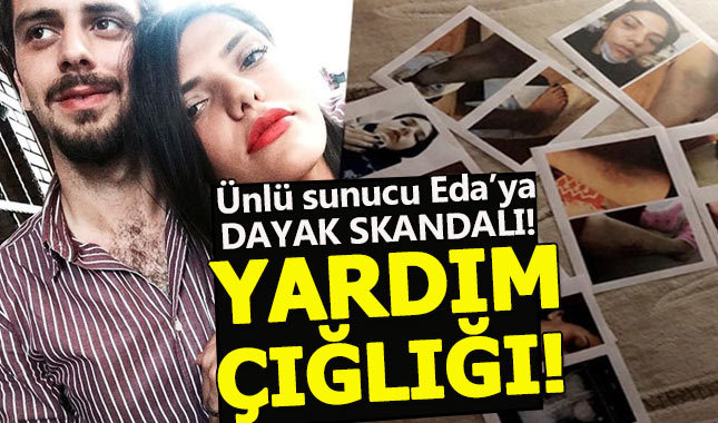 Şiddet gören Eda Pera Küçük yardım çağrısında bulundu
