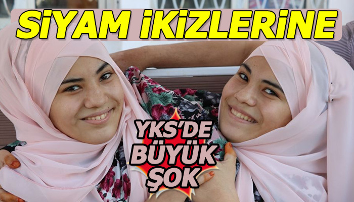 Siyam ikizlerine büyük şok!