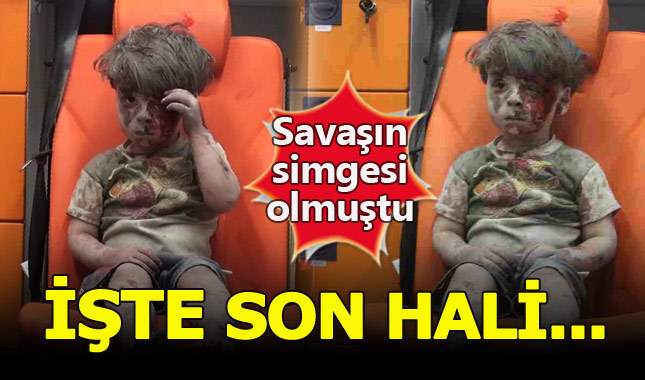 Suriye'deki savaşın simgesi Ümran bebeğin son hali...